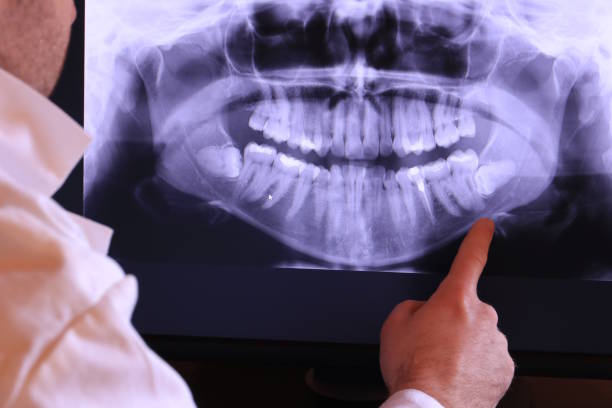 Best Emergency Dentist for Lost Fillings or Crowns in Beaufort, NC