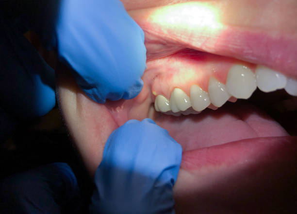 Best Emergency Dental Services for Seniors in Beaufort, NC